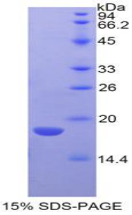 Recombinant Ly1 Antibody Reactive Homolog (LYAR)