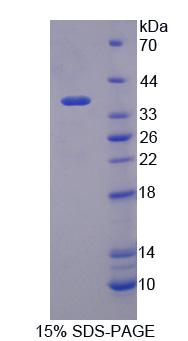 Recombinant MOCO Sulphurase C-Terminal Domain Containing Protein 1 (MOSC1)