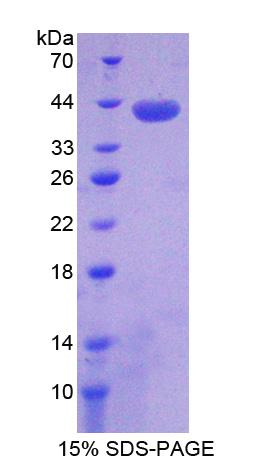 Recombinant Family With Sequence Similarity 135, Member B (FAM135B)