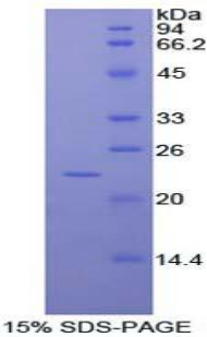 Recombinant RAD54 Like Protein 2 (RAD54L2)