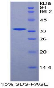 Recombinant Raft Linking Protein (Raftlin)
