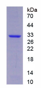 RPS152Hu01.jpg