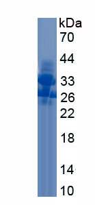 Recombinant Filaggrin 2 (FLG2)