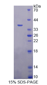 Recombinant A Disintegrin And Metalloprotease 1 (ADAM1)