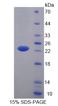 Recombinant Lipocalin 5 (LCN5)