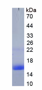 Recombinant Solute Carrier Organic Anion Transporter Family, Member 1B2 (SLCO1B2)