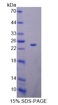 Recombinant Ribonuclease A11 (RNASE11)