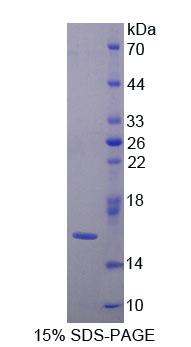 Recombinant Galectin 9B (GAL9B)