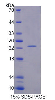 Recombinant Shisa Homolog 4 (SHISA4)