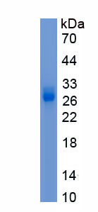 Recombinant Chromosome 1 Open Reading Frame 194 (C1orf194)