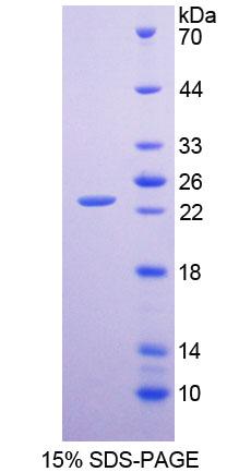 Recombinant Coxsackie And Adenovirus Receptor Like Membrane Protein (CLMP)