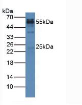 HRP-Linked Rabbit Anti-Gallus IgG Polyclonal Antibody