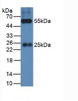 HRP-Linked Rabbit Anti-Cavia IgG Polyclonal Antibody