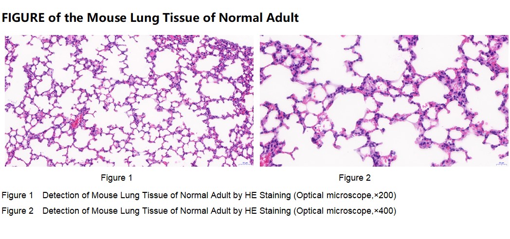 Mouse Lung Tissue of Normal Adult