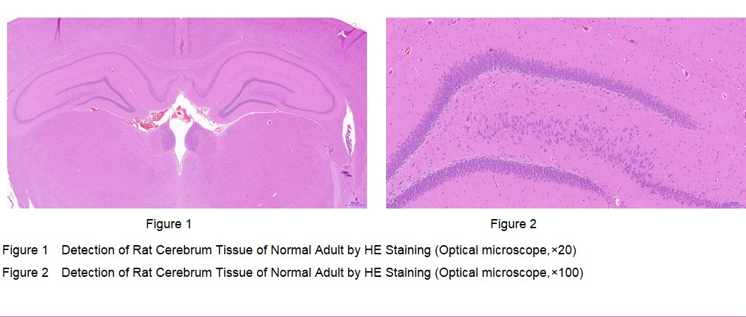 Rat Cerebrum Tissue of Normal Adult