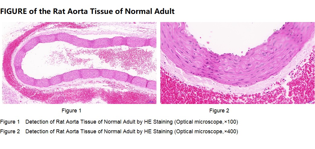 Rat Aorta Tissue of Normal Adult