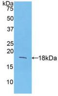 Active Fibroblast Growth Factor 1, Acidic (FGF1)