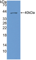 Active Chemokine (C-X-C Motif) Ligand 1 (CXCL1)