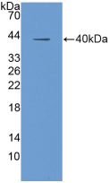 Active Insulin Like Growth Factor 1 (IGF1)