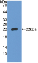 Active Insulin Like Growth Factor Binding Protein 3 (IGFBP3)