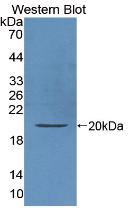 Active Interleukin 10 (IL10)