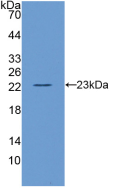 Active Interleukin 10 (IL10)