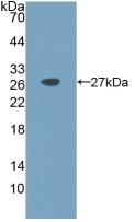 Active Interleukin 11 (IL11)