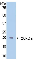 Active Interleukin 18 (IL18)