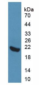 Active Interleukin 1 Receptor Type I (IL1R1)