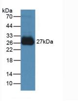 Active Interleukin 6 (IL6)