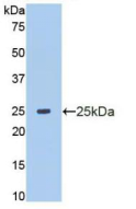 Active Matrix Metalloproteinase 13 (MMP13)