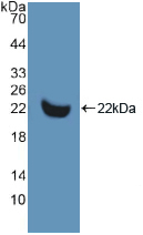 Active Matrix Metalloproteinase 13 (MMP13)