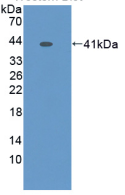 Active Prokineticin 2 (PK2)