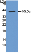 Active Stromal Cell Derived Factor 1 (SDF1)