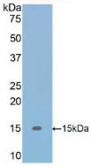 Active Transforming Growth Factor Beta 1 (TGFb1)