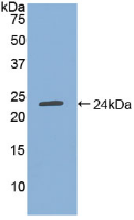 Active Tissue Inhibitors Of Metalloproteinase 4 (TIMP4)