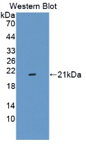 Active Tumor Necrosis Factor Alpha (TNFa)