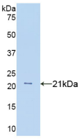 Active Tumor Necrosis Factor Alpha (TNFa)