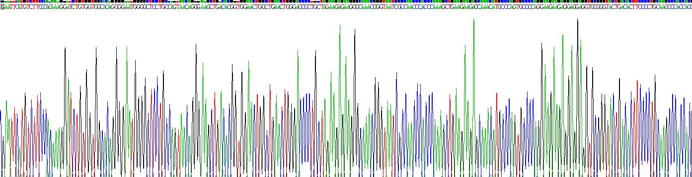 Active Adiponectin Receptor 1 (ADIPOR1)