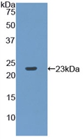 Active Ribonuclease P (RNASEP)