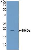 Active Interleukin 1 Receptor Antagonist (IL1RA)