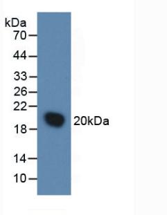 Active Interleukin 1 Receptor Antagonist (IL1RA)