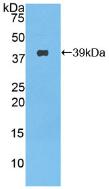 Active Nesfatin 1 (NES1)