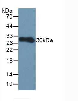 Active Paraoxonase 1 (PON1)