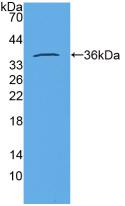 Active Insulin (INS)