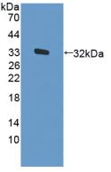 Active Protein Kinase R (PKR)