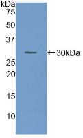 Active Tissue Factor (TF)