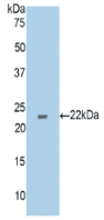 Active Tissue Plasminogen Activator (tPA)