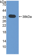 Active Epidermal Growth Factor (EGF)