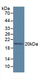 Active Interleukin 1 Beta (IL1b)